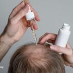 The Benefits and Risks of Hair Loss Drugs